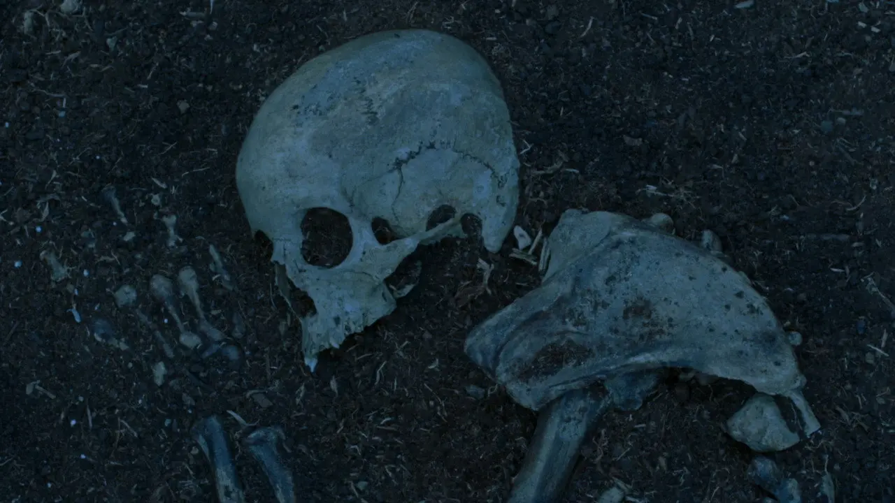 Bones
